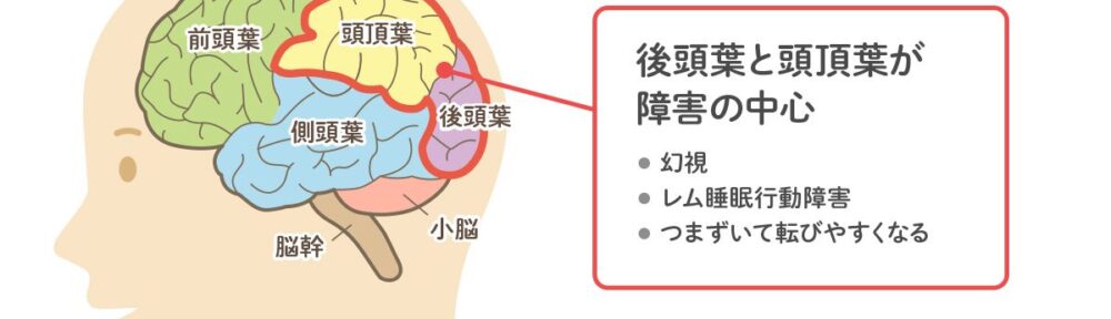受講生による継続遠隔ヒーリング体験談（認知症の妄想）