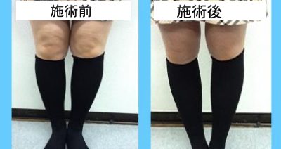 気功エステ（２月限定サービス）のお知らせ