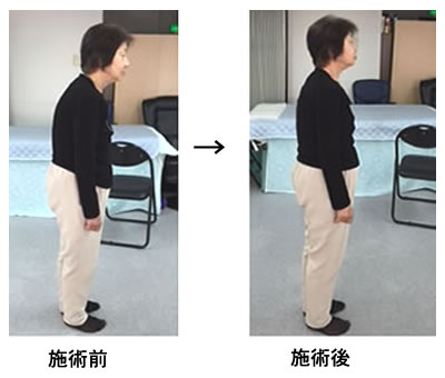 気功エステ（２月限定サービス）のお知らせ